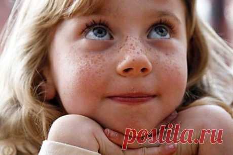 Как избавиться от веснушек на лице

Некоторые женщины стараются спокойно уживаться с веснушками (ну есть они и что?). Другие тоже смиряются, но не так охотно (просто стараются не зацикливать на них свое внимание). Третьи – их, наверное, явное меньшинство – считают эти точечки на лице даже пикантными.

Ну а тем из вас, милые дамы, кто буквально грезит мечтой избавиться от этой пигментации, мы решили посвятить нашу статью.