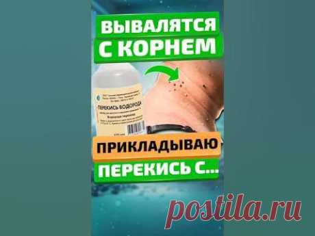 Как избавиться от папиллом быстро и дёшево?Нанесите на каждую бородавку трёхпроцентный раствор перекиси водорода. Делайте это три-пять раз в день. А дополнит...