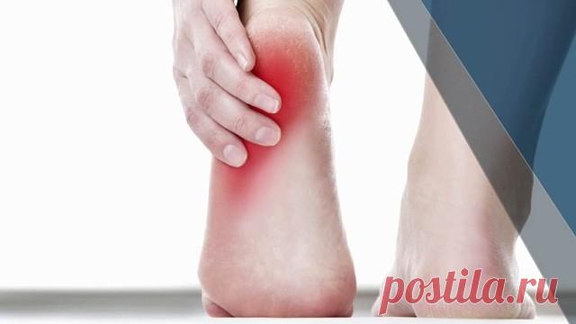 ШПОРУ ЗА 3 ДНЯ
Поделюсь рецептами от пяточных шпор. Прошлым летом на юге после ванн у меня так разболелась нога, что я не знала, куда ее деть. Пятка горела огнем. Приехав домой, побежала к хирургу. Молодая врач сделала снимок и объявила, что у меня после ванн обострилась пяточная шпора. Дала мне какую-то «памятку» - и все. Я поняла, что надо самой лечиться. Обратилась к народной медицине - стала искать рецепты от шпор. Все, что нашла, выписала и посылаю вам. Ведь сколько е...