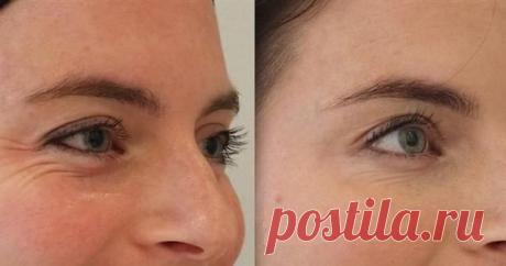 Скажите до свидания усталым, опухшим, темным кругам и морщинам под глазами с этим чудесным средством - Советы на каждый день