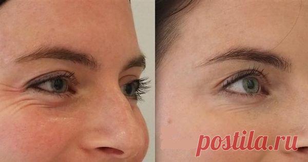 Скажите до свидания усталым, опухшим, темным кругам и морщинам под глазами с этим чудесным средством - Советы на каждый день