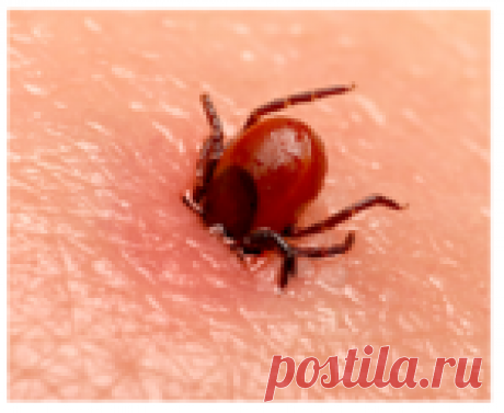 🕷️ Извлечение клеща или что делать если обнаружили его