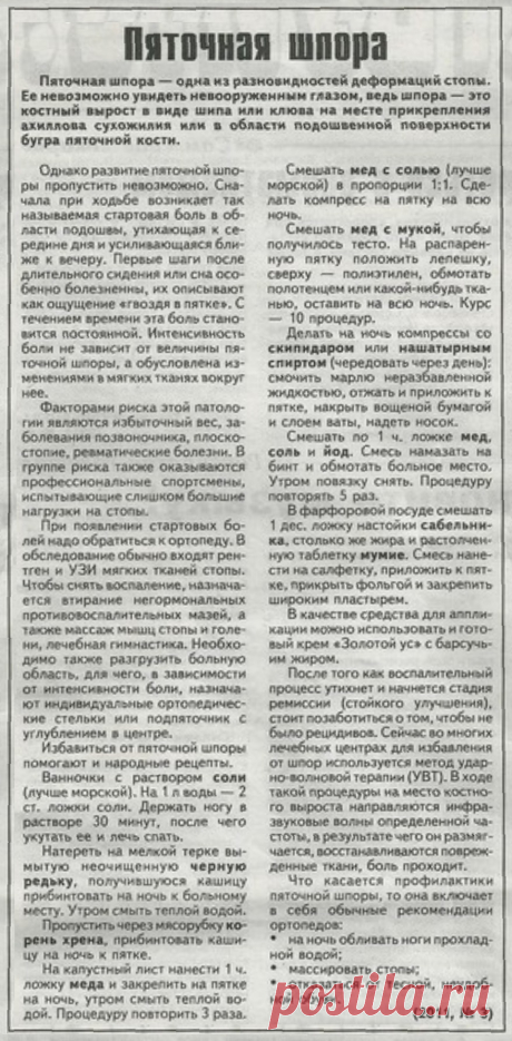 Пяточная шпора