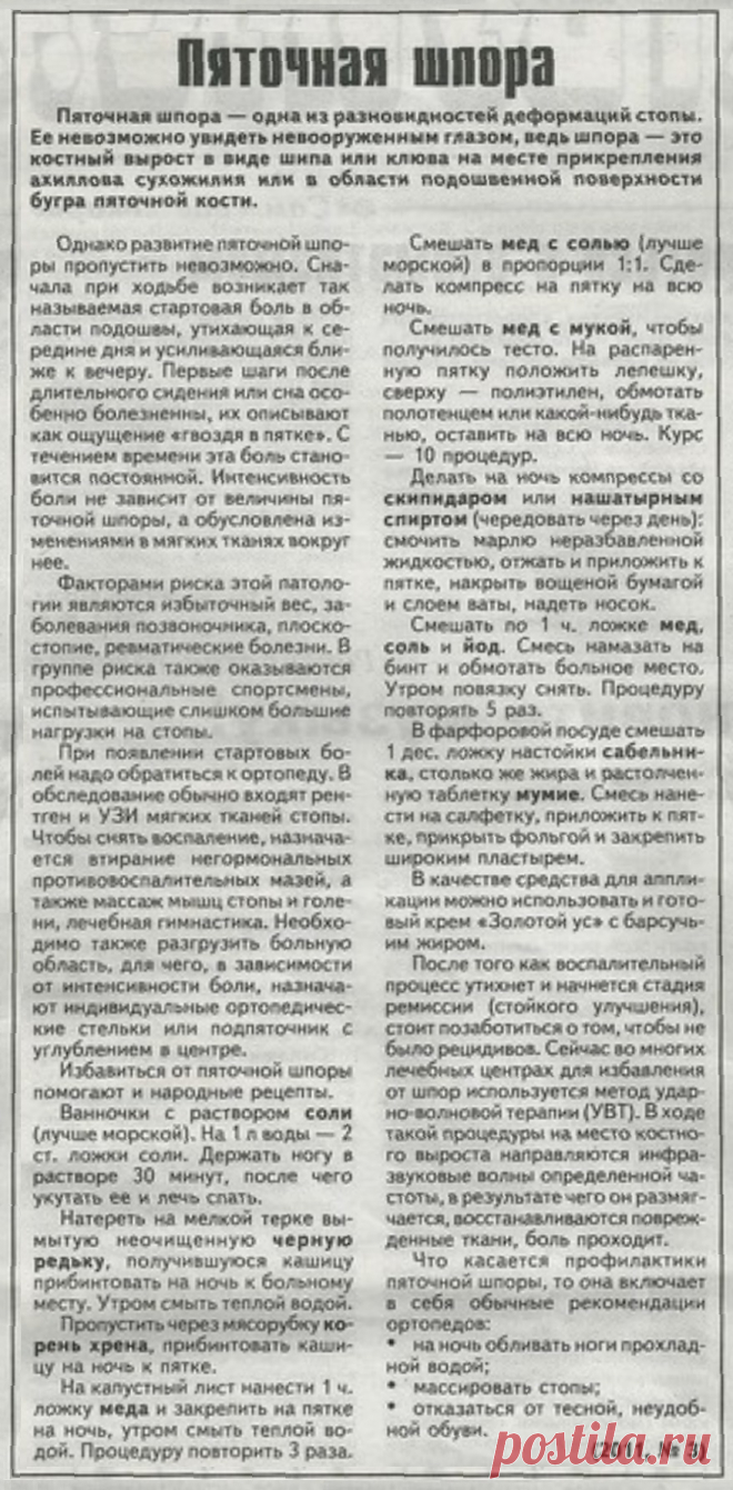 Пяточная шпора