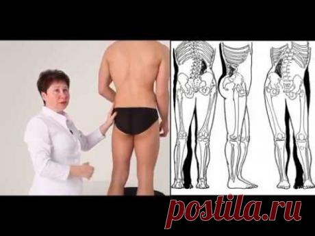 Прикладная кинезиология. Мастер-класс Людмила Васильева ПЕРЕКОС ТАЗА.