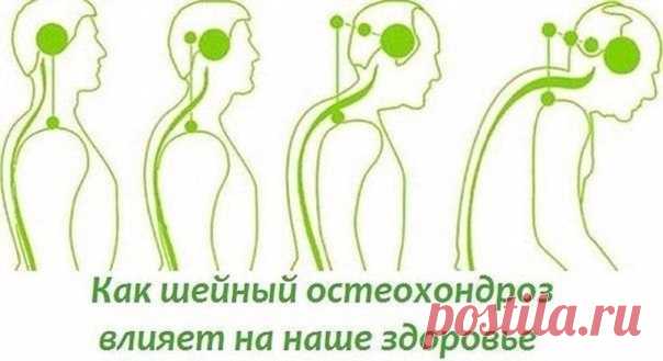 О шейном остеохондрозе

На начальном этапе изменения претерпевают кости и связки. И о том наш организм сигнализирует периодической болью или нарушением чувствительности отдела, пораженного остеохондрозом. Затем появляются трещины и меняется высота стояния диска, а точки прикрепления мышц и связок, принадлежащие двум соседним позвонкам, сближаются.

Поэтому мышцы и связки провисают и позвонки начинают легко соскальзывать или смещаться относительно друг друга. Тогда к боли д...