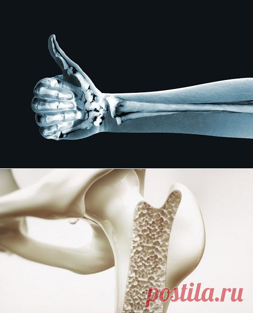 Как улучшить здоровье костей