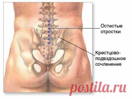Сакроилеит, диагностика и лечение сакроилеита - БорисК | Дневники.Ykt.Ru