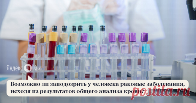 «Возможно ли заподозрить у человека раковые заболевания, исходя из результатов общего анализа крови?» – Яндекс.Кью 08 июня 2020 Андрей Львович Пылёв ответил: Раком называют злокачественные опухоли эпителиального происхождения. Но их ассортимент на этом не исчерпывается. Есть еще саркомы — опухоли, произрастающие из соединительной ткани (мышцы, кости), лимфомы — злокачественное поражение лимфатической системы и лейкозы — злокачественное поражение системы кроветворения.

Общ...