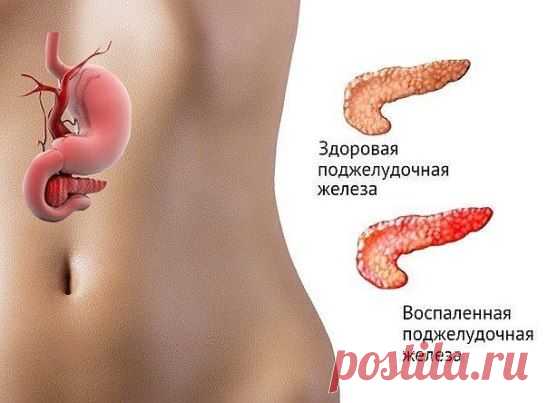 Если беспокоит поджелудочная железа......