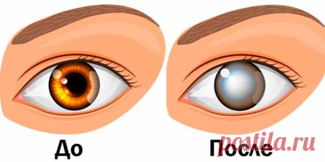 Офтальмологи предупреждают! Никогда не делайте этого! Это приводит к слепоте и не только… - Полезные советы Уже сейчас врачи настоятельно рекомендуют отказаться от этой привычки! Врачи были озадачены, когда две женщины, в возрасте 35 и 44 лет, сообщили о повторяющихся эпизодах слепоты, продолжительностью до 15 минут. После бесчисленных обследований, сканирования и других медицинских т...