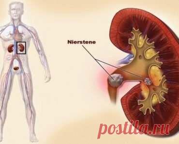 Старинное средство очищает почки, устраняет песок, слизь, растворяет камни и исцеляет цистит!