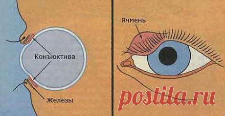 ЯЧМЕНЬ ГЛАЗ. НАРОДНЫЕ МЕТОДЫ ЛЕЧЕНИЯ ЯЧМЕНЯ ГЛАЗ .