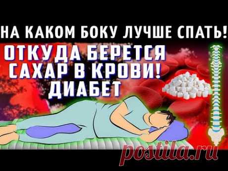 НА КАКОМ БОКУ НУЖНО СПАТЬ! ОТКУДА БЕРЕТСЯ САХАР В КРОВИ, ДИАБЕТ! Островский. Как правильно спать