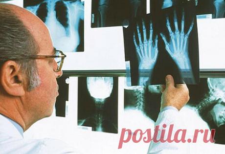 Ревматоидный артрит: симптомы, лечение, диагностика