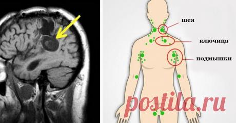 Вот, что провоцирует и ускоряет рост клеток рака в нашем теле! Узнай лучшие способы, чтобы остановить это!