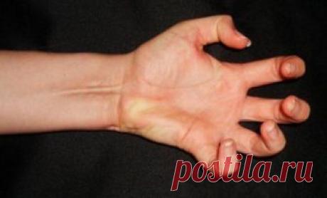 9 удивительных, а иногда и необъяснимых фактов о человеческом теле Человеческое тело хранит в себе множество секретов. 1. У 15% людей отсутствуют длинные ладонные мышцы.Отсутствие этого сухожилия никак не влияет на силу захвата. Но, когда возникает необходимость тран...