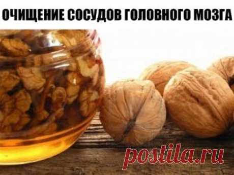 ОЧИЩЕНИЕ СОСУДОВ ГОЛОВНОГО МОЗГА. НАРОДНЫЕ СРЕДСТВА ЛЕЧЕНИЯ. 5 РЕЦЕПТОВ 

1. Благодаря этому средству сосуды становятся эластичными, исчезает головокружение и шум в ушах, улучшается обмен веществ, очищается организм:
Измельчите и смешайте по 100 граммов ромашки, зверобоя, бессмертника, березовых почек. 1 столовую ложку этой смеси залейте кипятком (0,5 литра), настаивайте 20 минут, процедить и отжать. Вечером, перед сном, перелейте половину настоя в стакан, добавьте 1 чайну...