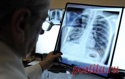 Пневмония. Что нужно знать. Ежегодно 12 ноября проходит Всемирный день борьбы с пневмонией. Инфекционные болезни легких входят в пятерку самых частых причин смерти в мире. В этом материале мы расскажем, из-за чего бывает пневмония и как защитить себя в опасный сезон