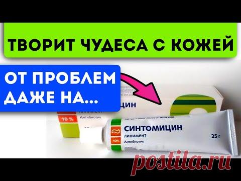 Боялась даже смотреть в зеркало, но через день ... копеечный синтомицин убрал все прыщи, язвы и ...