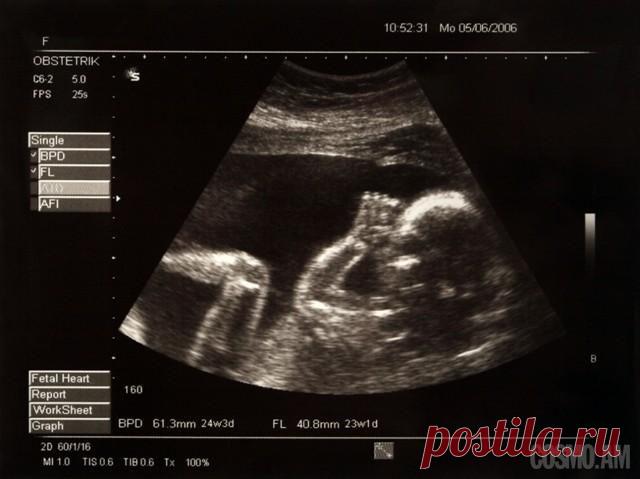 Аплодисменты в животике у мамы