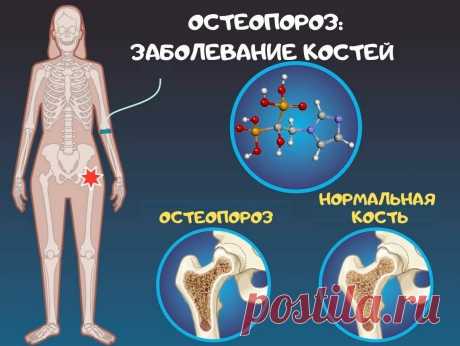 Продукты с высоким содержанием витамина Д | О полноценной жизни с больным сердцем. Анна Кореневич. Кардиолог | Яндекс Дзен