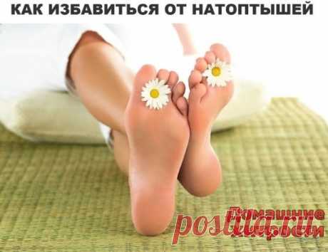 Избавляемся от натоптышей на ногах. Требуется: мыльно-содовая ванночка для ног - сода, хозяйственное мыло, вода. Маска от натоптышей: аспирин, лимонный сок, вода, полиэтилен. Делаем ванночку. Для этого возьмем 3 чайные ложки соды и 1 столовую ложку наструганного хозяйственного мыла. Все это растворим в 1 литре горячей воды (Если у вас емкость для ножных ванночек большая, то увеличьте пропорционально все компоненты). Опустим в раствор ноги и подержим минут 30−40.
Готовим маску от натоптышей. Раз