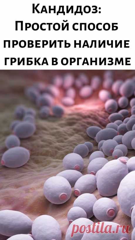 Кандидоз: Простой способ проверить наличие грибка в организме