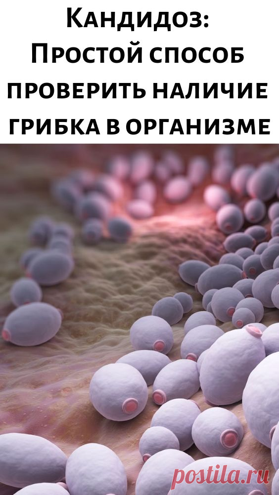 Кандидоз: Простой способ проверить наличие грибка в организме