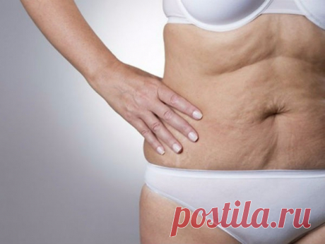 МОРЩИНИСТАЯ ШЕЯ, ДРЯБЛЫЕ РУКИ И РЫХЛЫЕ БЕДРА В ПРОШЛОМ! ЭТО СРЕДСТВО ОГОРЧИТ ПЛАСТИЧЕСКИХ ХИРУРГОВ