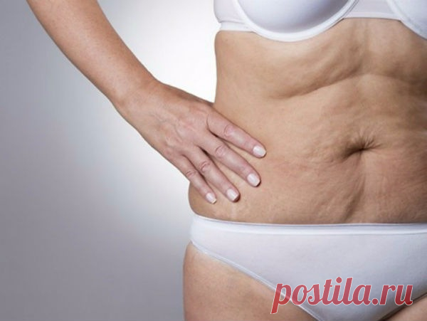 МОРЩИНИСТАЯ ШЕЯ, ДРЯБЛЫЕ РУКИ И РЫХЛЫЕ БЕДРА В ПРОШЛОМ! ЭТО СРЕДСТВО ОГОРЧИТ ПЛАСТИЧЕСКИХ ХИРУРГОВ