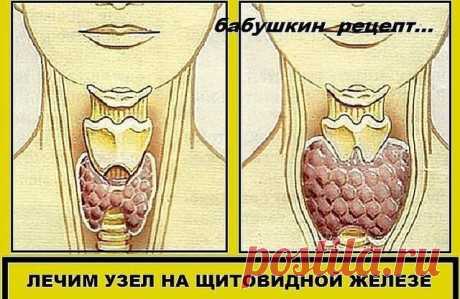(95) Одноклассники