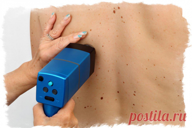 Созвездие большой медведицы на теле из родинок. П. Глоба Знаки Верхнего Зодиака и связанные с ними Созвездия