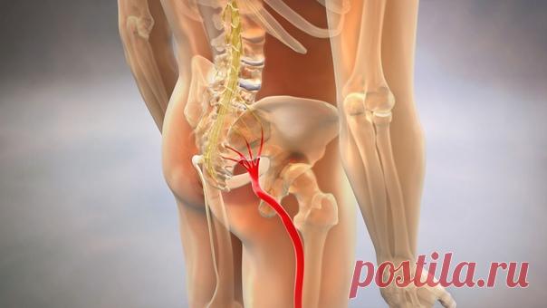 Почему могут болеть ноги при радикулите?

Боли в ногах сопровождают различные заболевания. Одним из них может стать радикулит. Почему возникают боли в ногах при радикулите? Как не запустить заболевание? Чем его можно вылечить?

Почему возникает радикулит?
Заболевание радикулит связано с нарушениями кровоснабжения периферийной нервной системы. Иными словами, происходит гипоксия (кислородное голодание) нервного корешка. Оно может быть вызвано деформациями суставов, а именно:...