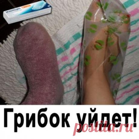 Внутрисуставные уколы