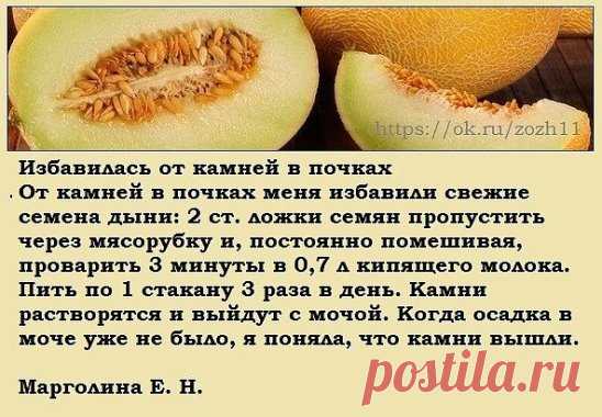 Камни в почках