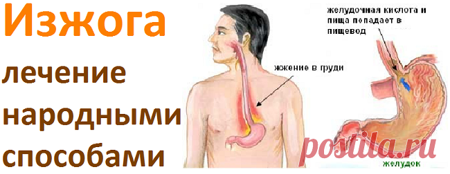 Лечение изжоги народными способами | Советы целительницы