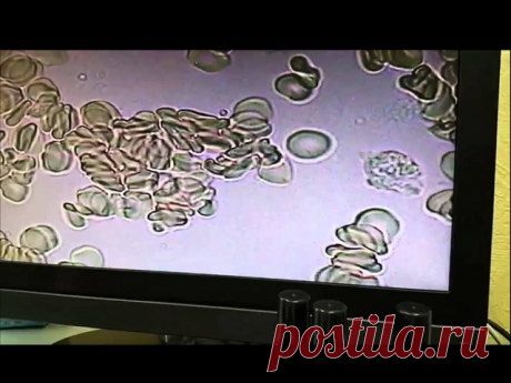 Так работают спреи  ком ALivemax