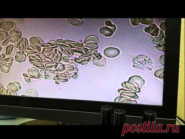 Так работают спреи  ком ALivemax