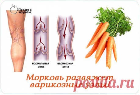 Морковь развяжет варикозные узлы! | Женский журнал
