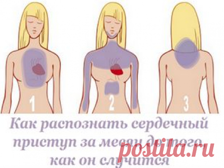 КАК РАСПОЗНАТЬ СЕРДЕЧНЫЙ ПРИСТУП ЗА МЕСЯЦ ДО ТОГО, КАК ОН СЛУЧИТСЯ.  Главное - наблюдательность!