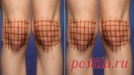 Беспокоят суставы? Болезни суставов очень многообразны и причиняют много неудобств больным.
Лечение может стать довольно затяжным процессом. Поддержать свой организм в это время и ускорить выздоровление помогут народн…