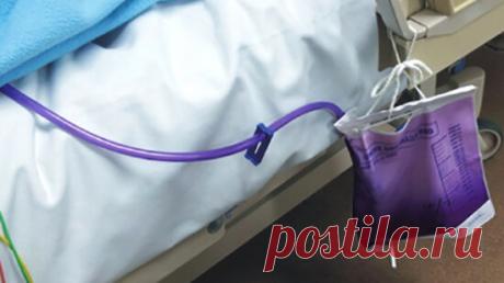 Может ли моча быть фиолетовой и нормально ли это?
Цвет мочи – это важный показатель здоровья не только почек и мочевыделительной системы, но и всего организма в целом. У здоровых людей в зависимости от объем потребляемой жидкости и температуры окружающей среды, потоотделения, моча имеет цвет от бледно-желтого, до янтарного, соломенного. Некоторые продукты питания или напитки с естественными или искусственными красителями могут временно окрашивать мочу […]
Читай дальше на сайте. Жми подробнее ➡