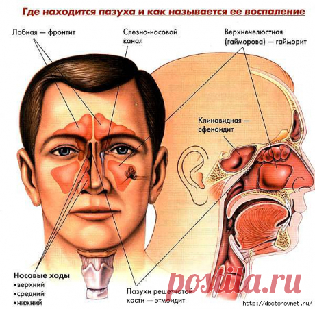 Домашнее лечение гайморита | Правила здоровья и долголетия