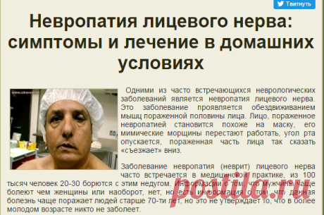 Невропатия лицевого нерва: симптомы, причины и лечение неврита в домашних условиях | НАРОДНАЯ МЕДИЦИНА