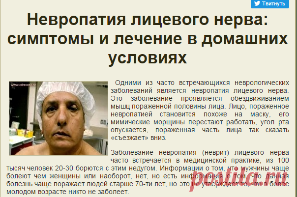 Невропатия лицевого нерва: симптомы, причины и лечение неврита в домашних условиях | НАРОДНАЯ МЕДИЦИНА
