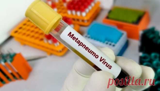 Метапневмовирус - вот что нужно знать о нем - ФОКУС ВНИМАНИЯ