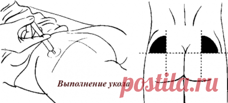 Лечение шишек после уколов