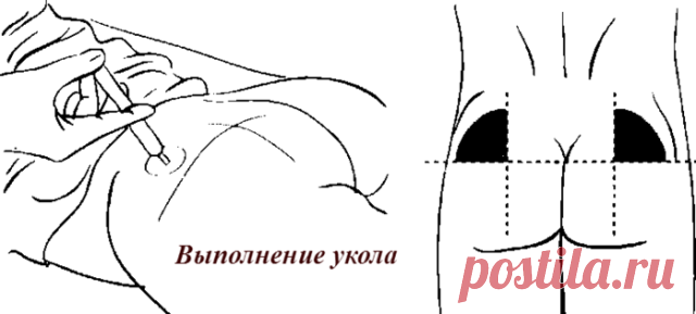 Лечение шишек после уколов