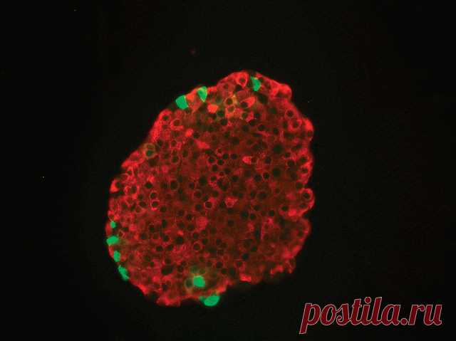 Клетки поджелудочной железы способны к перемене участи